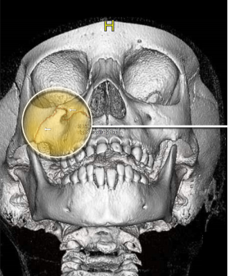 schuster law image 8